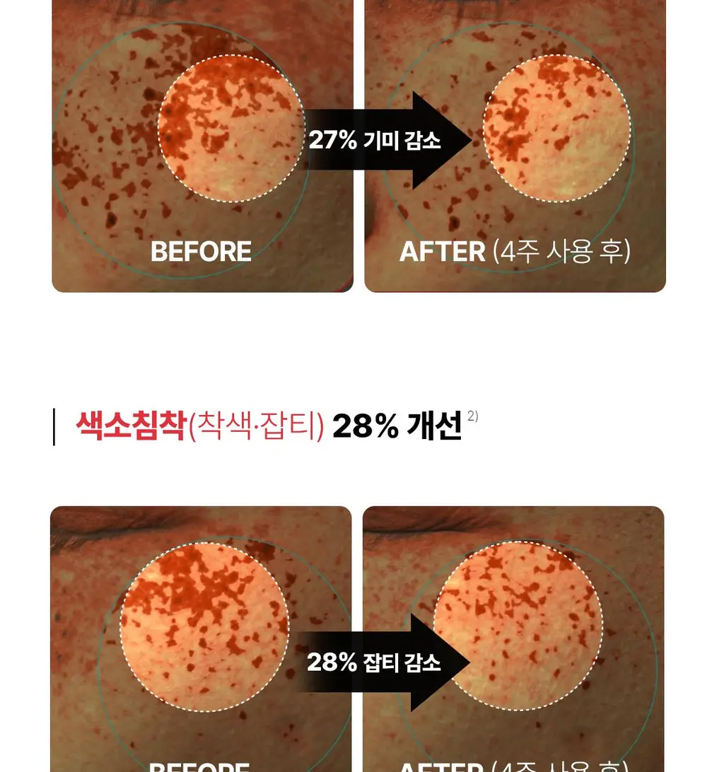 [기미톤업/색소침착] 동국제약 멜라-셋 기미 토닝 크림 35g 더블 기획(+기미 와이드 패치 2매입*2ea) 상세페이지 19